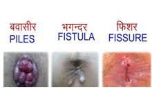 Ayurvedic Clinic in Jharsuguda, Sexologist Doctors in Jharsuguda, Ayurvedic Doctors in Jharsuguda